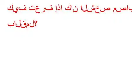 كيف تعرف إذا كان الشخص مصابًا بالقمل؟